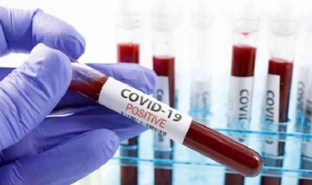 Koronavirüs Cezası Ödeyenler Paralarını İade Almaları için Başvuru Formu Yayınlandı;