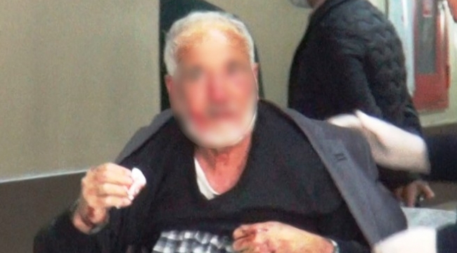 Şanlıurfa'da köpek saldırısına uğrayan adam yaralandı ;